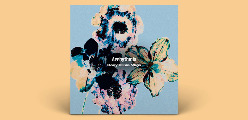 Arrhythmia