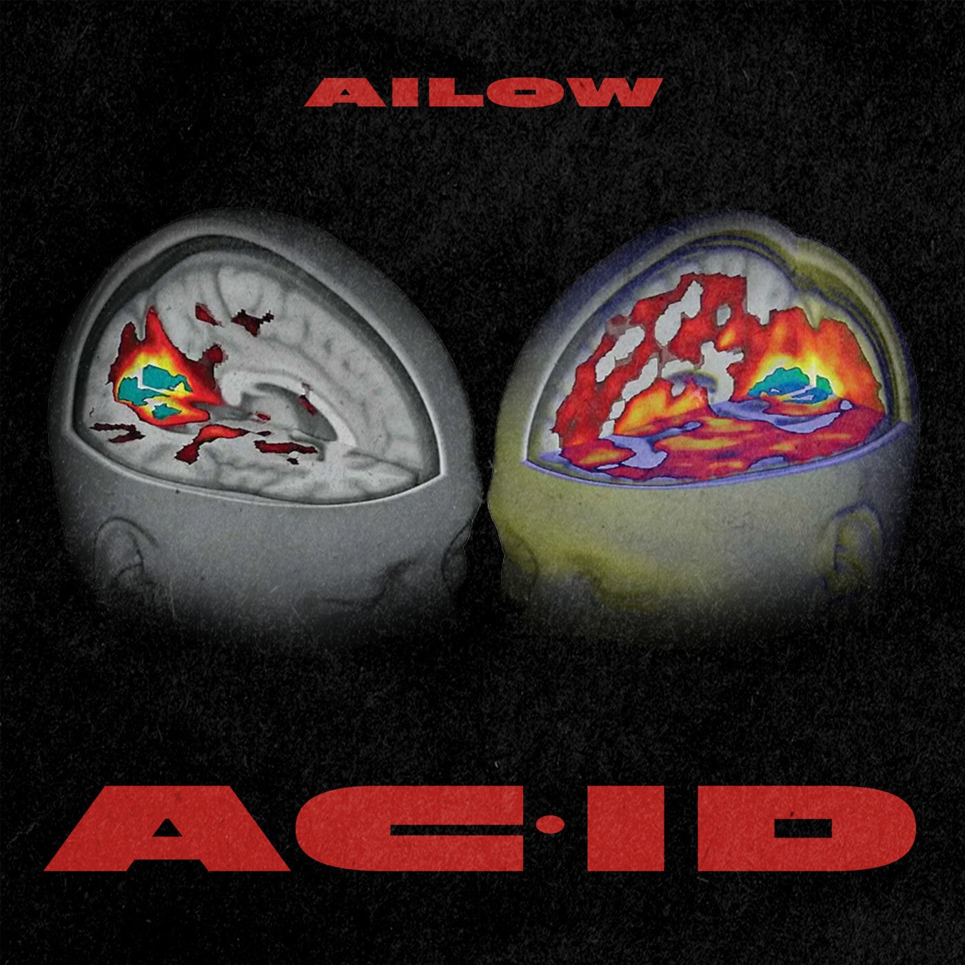 ac·id (Extended Mix)