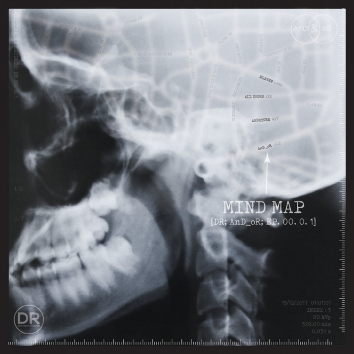 Mind Map EP