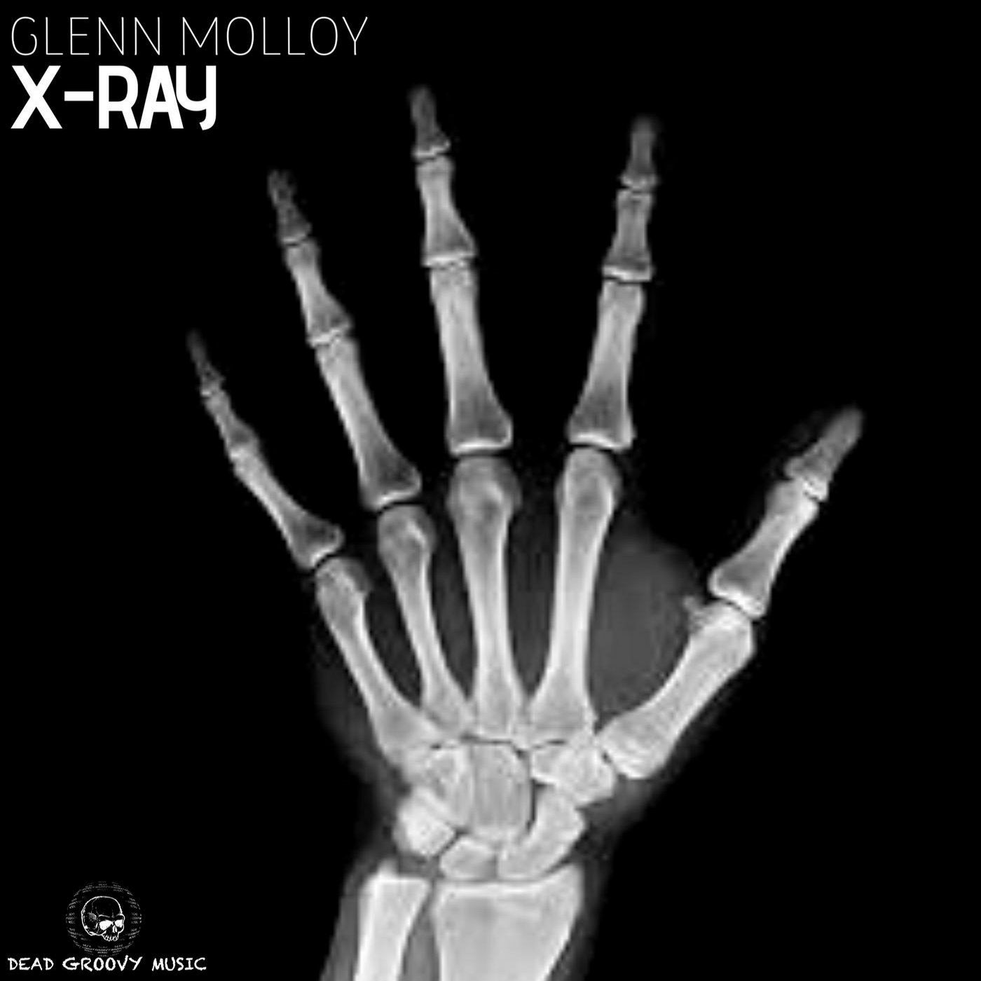 X-Ray