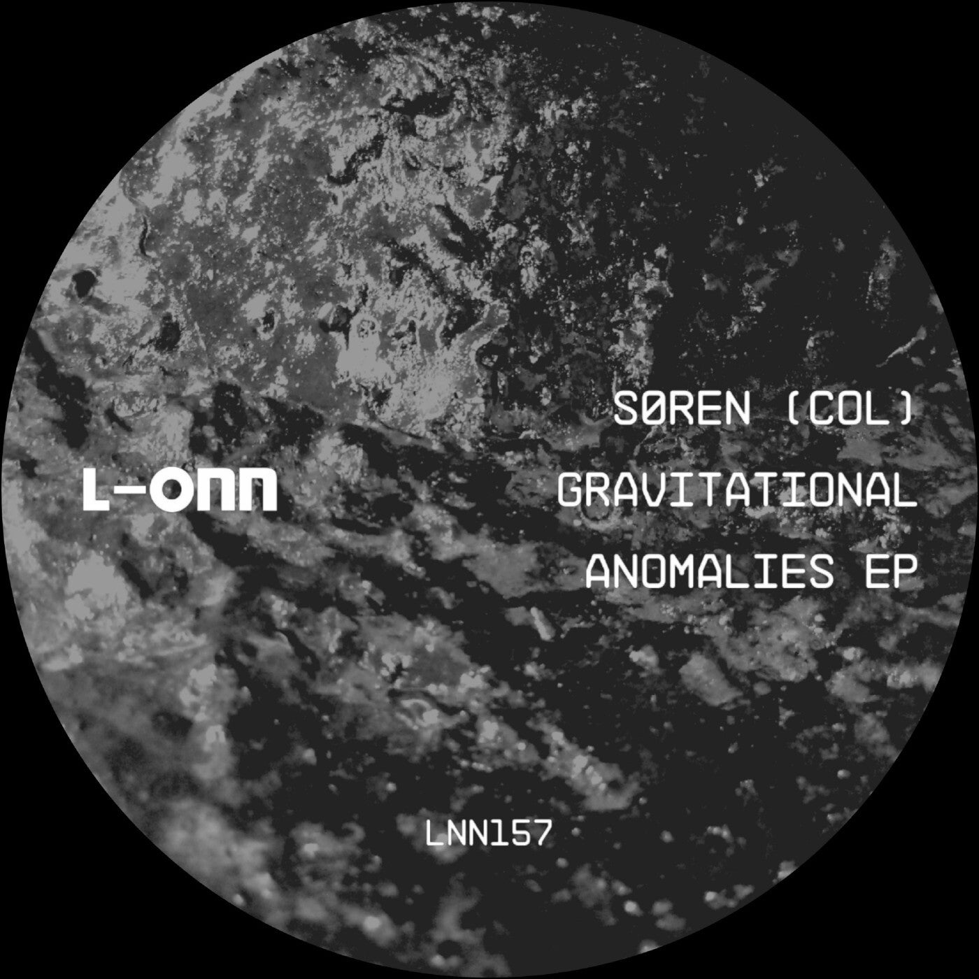 Gravitational Anomalies EP