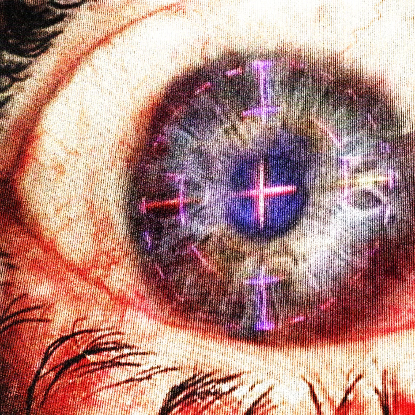 GLAUCOMA