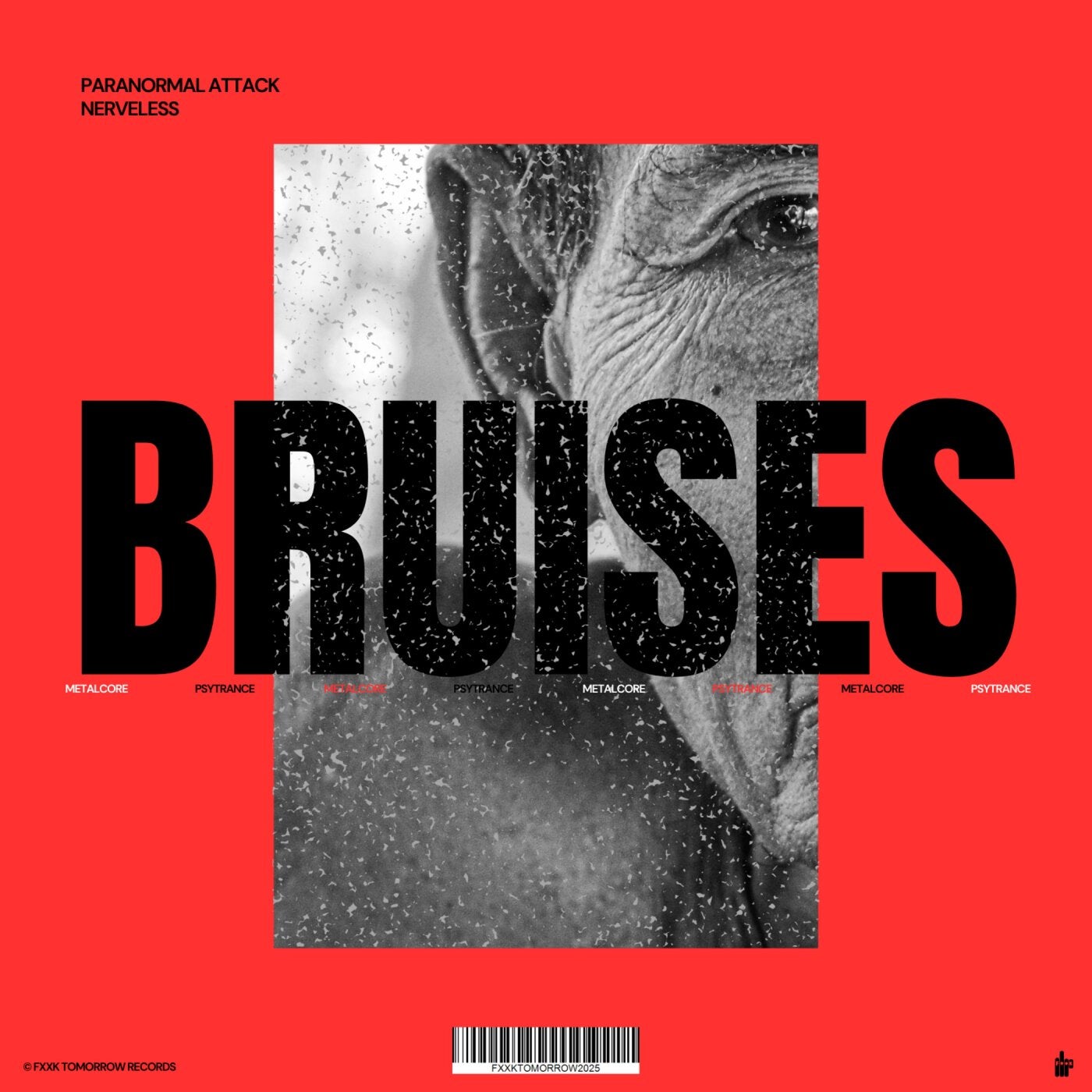 Bruises