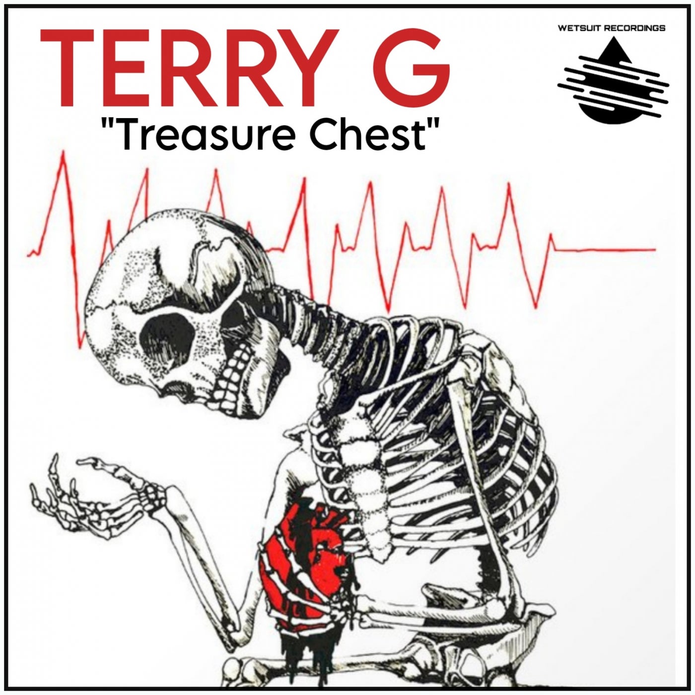 Treasure Chest