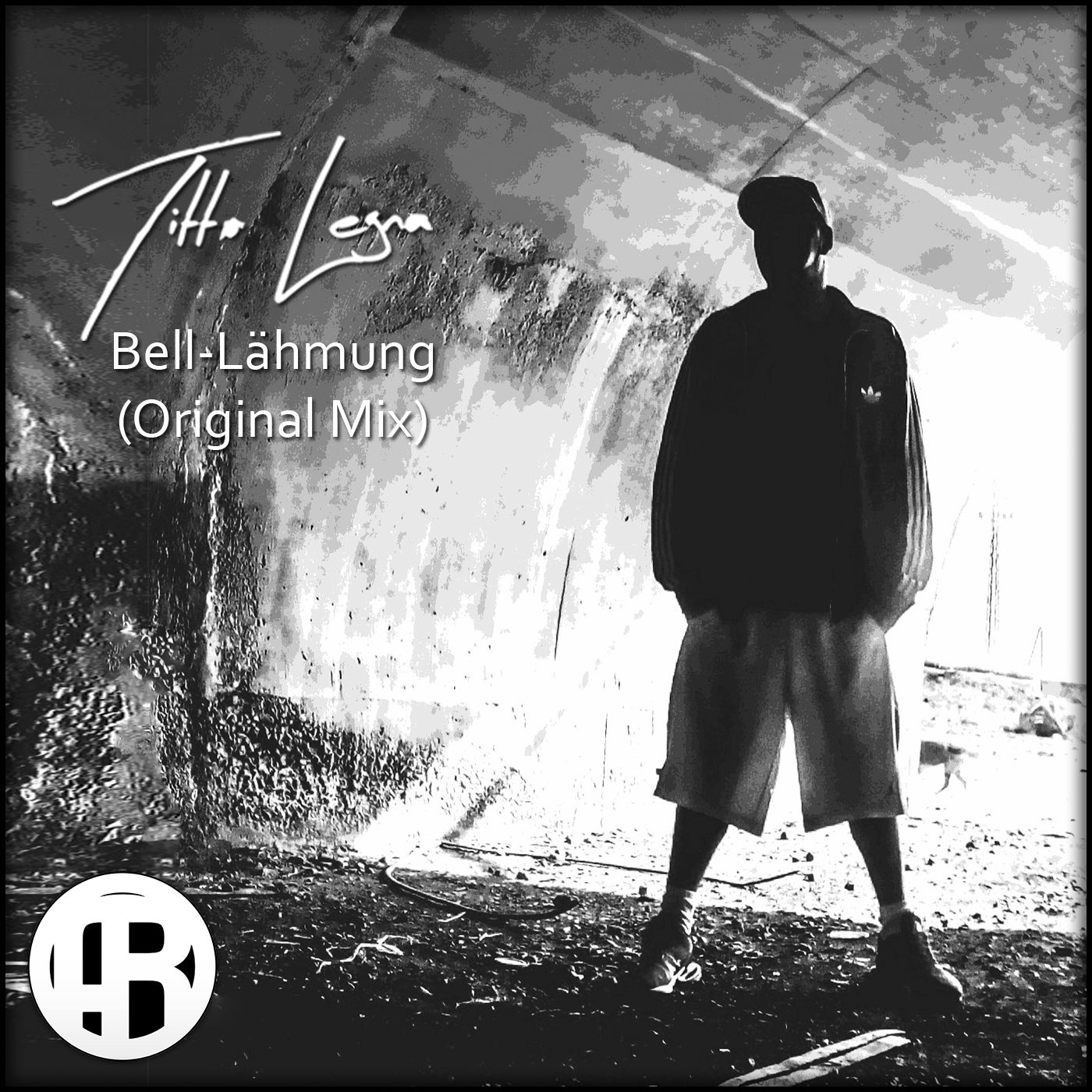 Bell-Lähmung