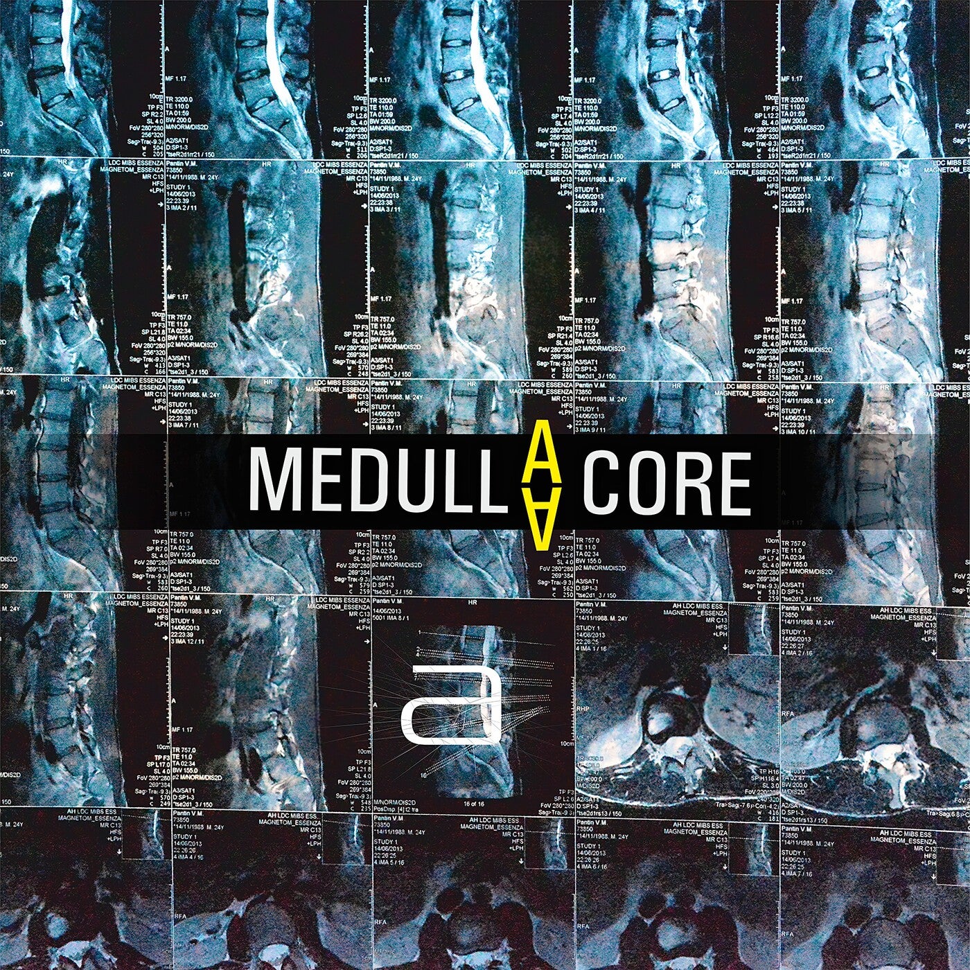 Medulla Core