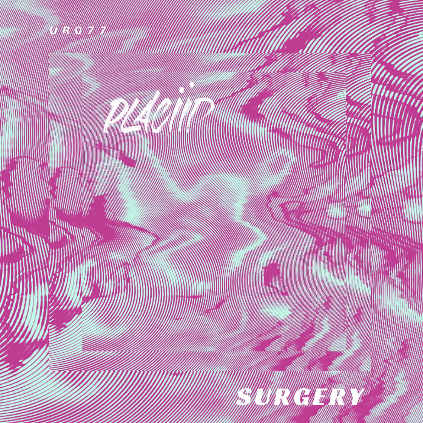 SURGERY