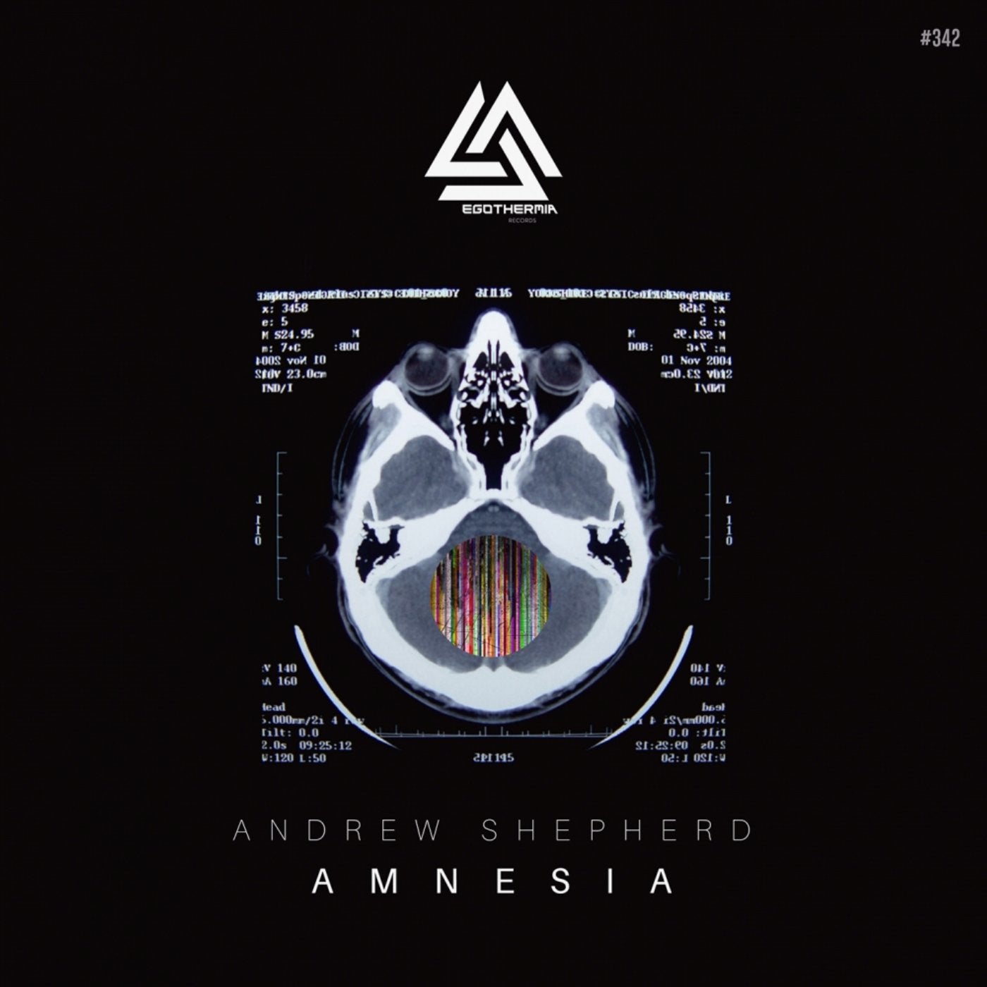 Amnesia