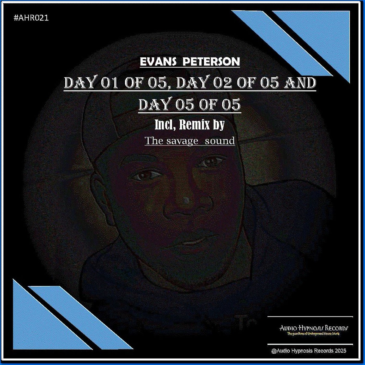 Day 1 of 5, Day 2 of 5 and Day 5 of 5 (Laboratory Mix)