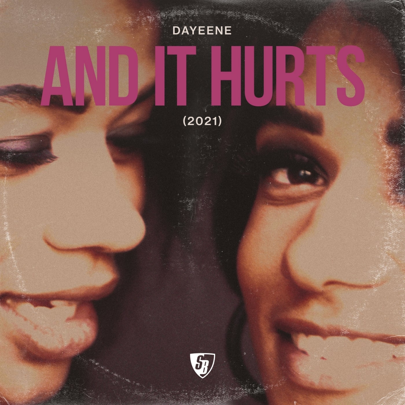 And It Hurts (2021 Remixes)