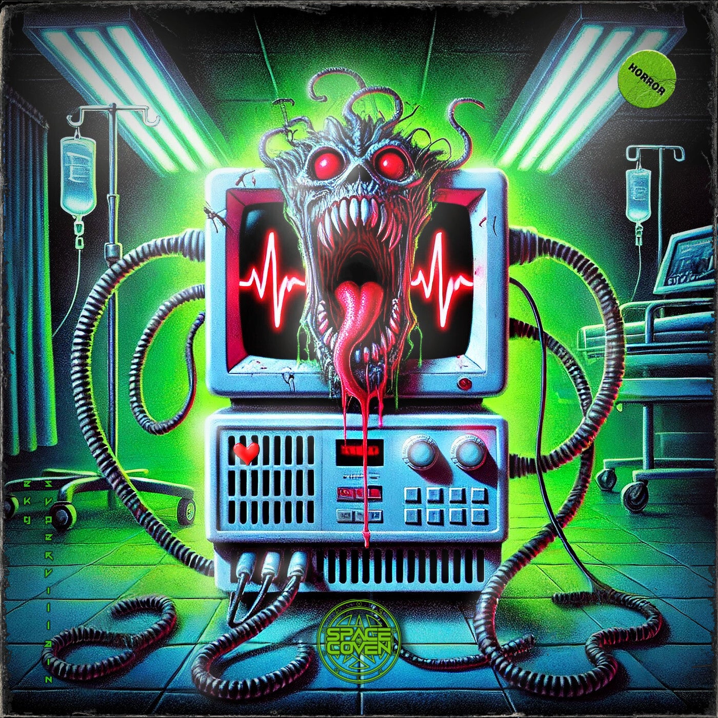 EKG