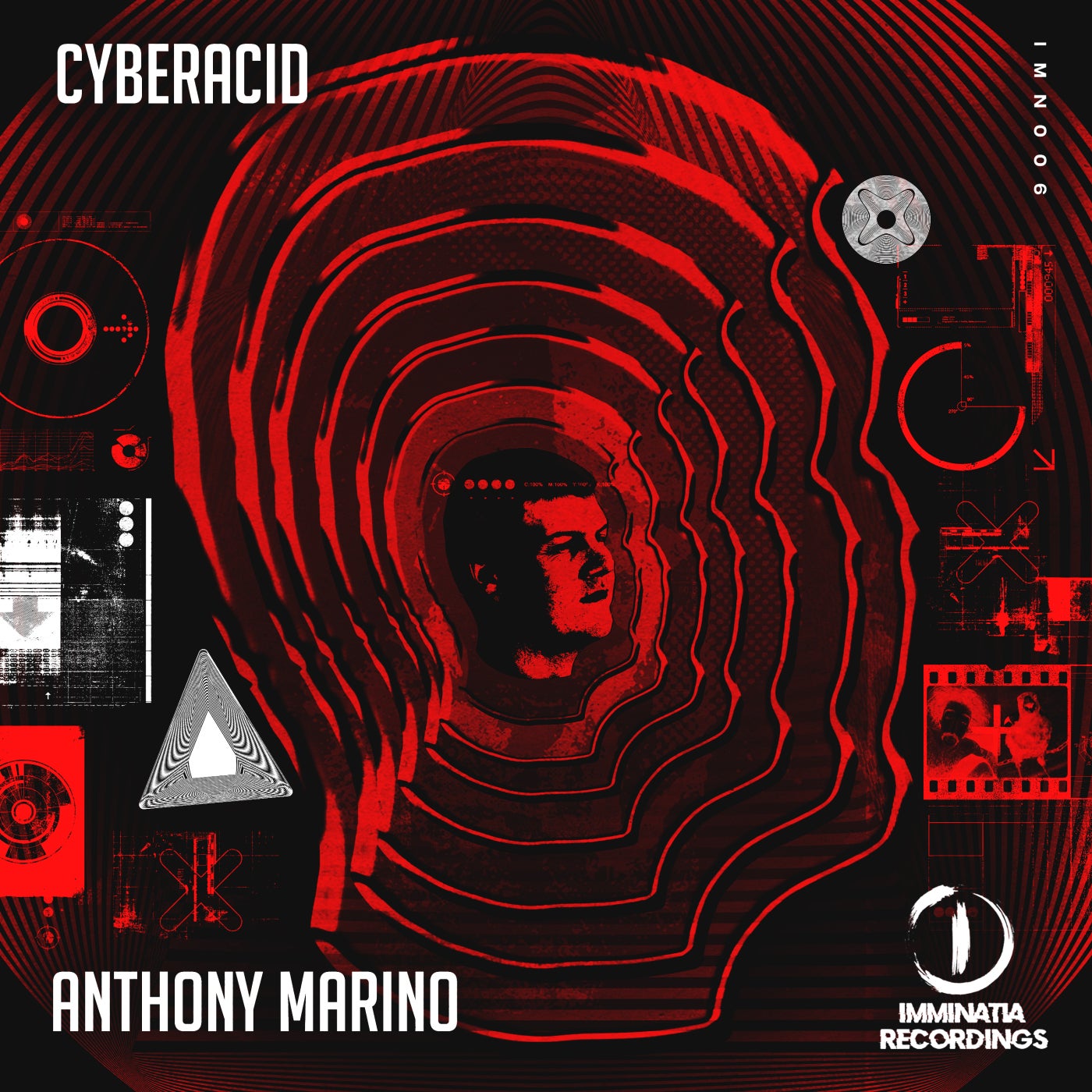 Cyberacid