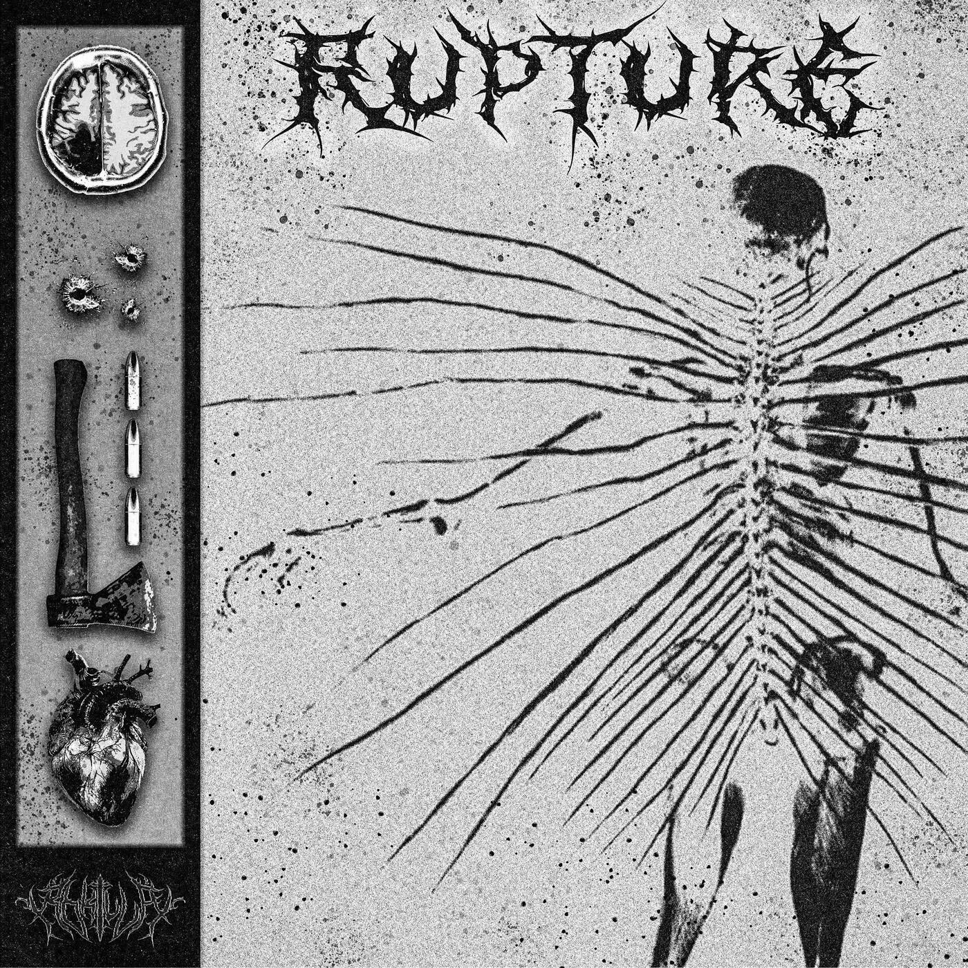 RUPTURE