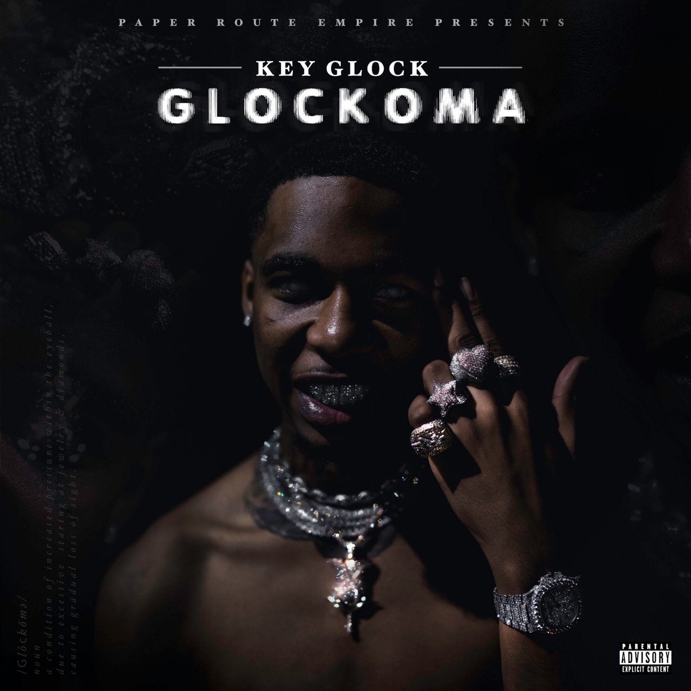 Glockoma