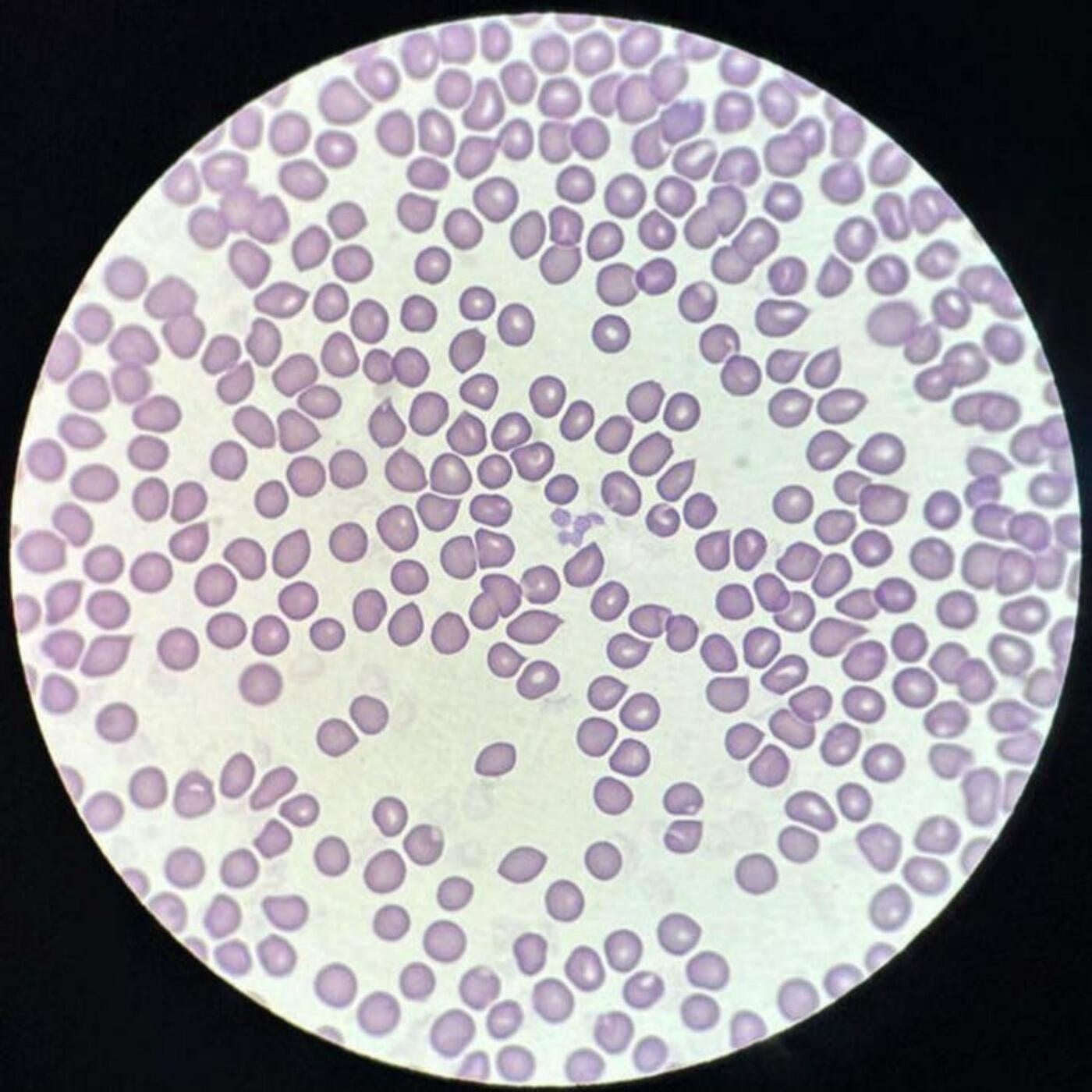 Plasma