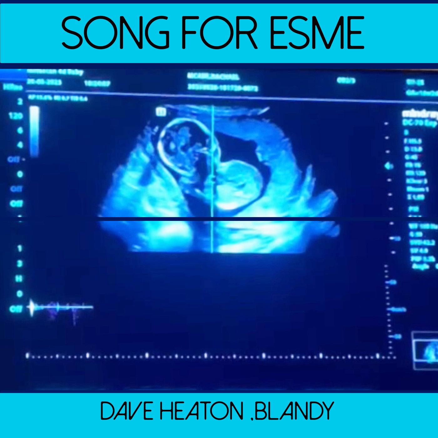 Song For Esme