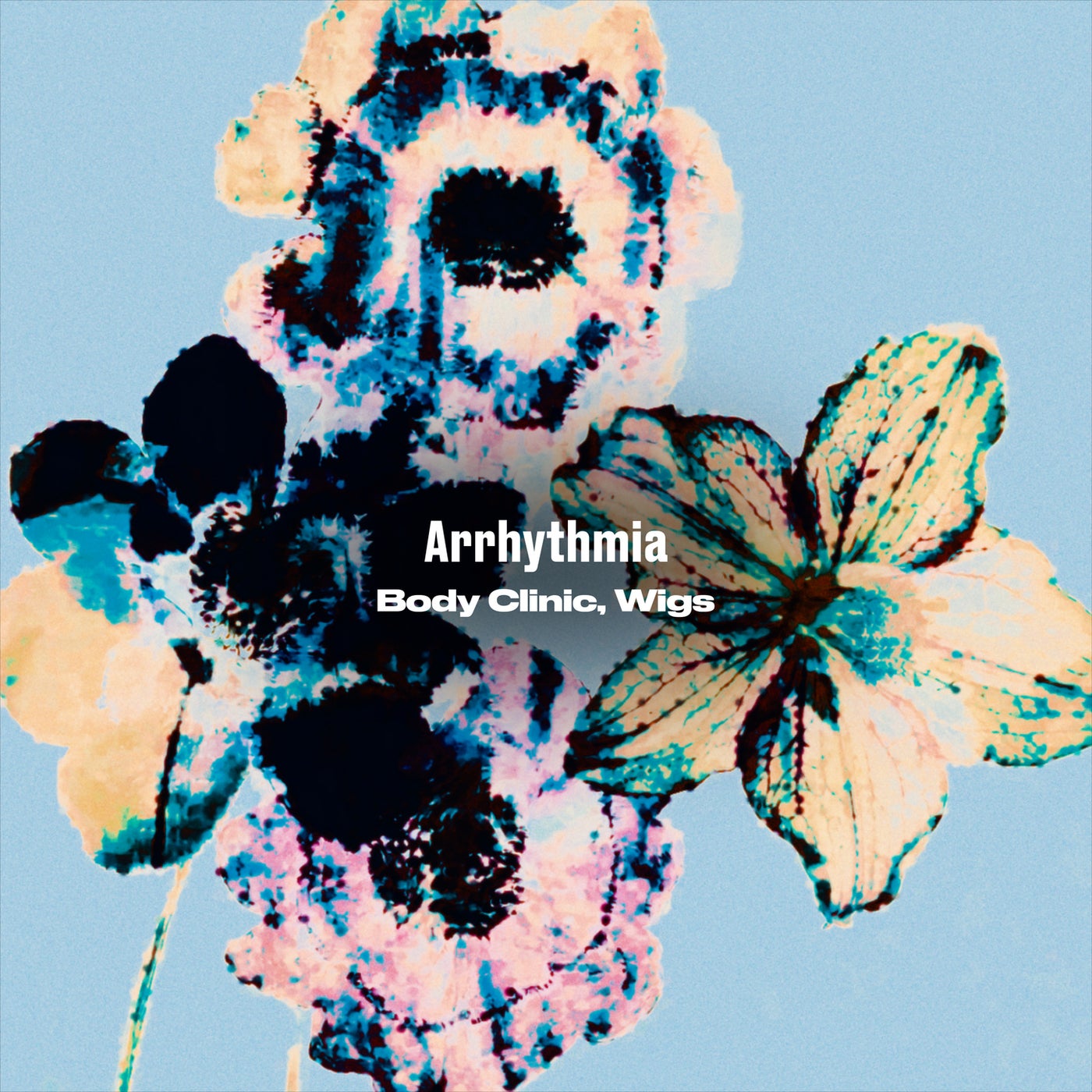 Arrhythmia