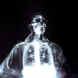 X-Ray