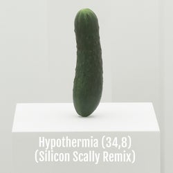 Hypothermia (34,8)