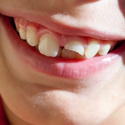 Smiling while Dancing