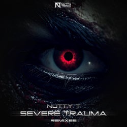 Severe Trauma (Remixes)