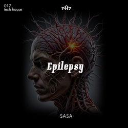 Epilepsy