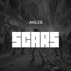 Scars