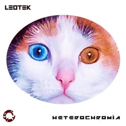 Heterochromia
