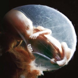 Embryo