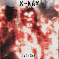 X-ray