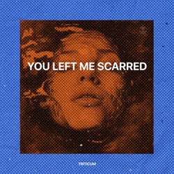 You Left Me Scarred