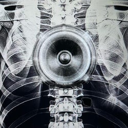 Opening Set - Frenetic