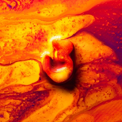 Imperfect Love 