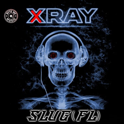 XRAY