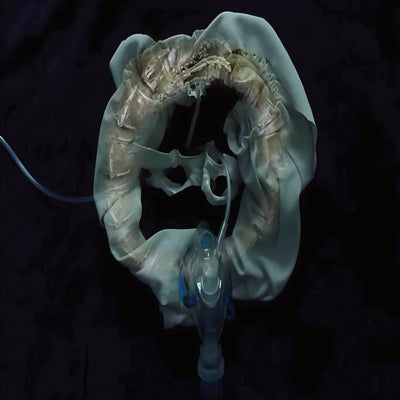 InitiatriX