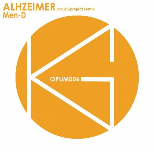Alhzeimer
