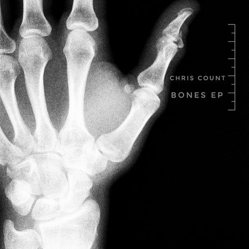 Bones Ep