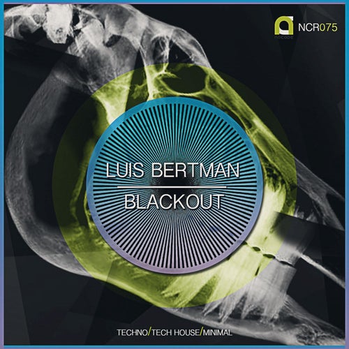 Blackout Ep.