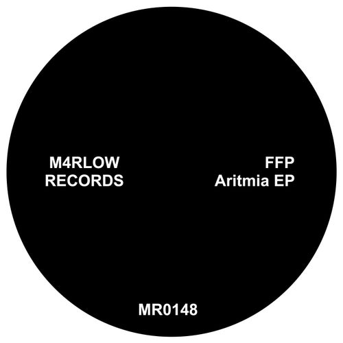 Aritmia EP