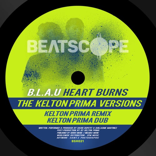 Heart Burns (The Kelton Prima Versions)