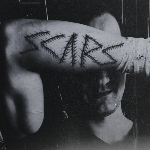 Scars