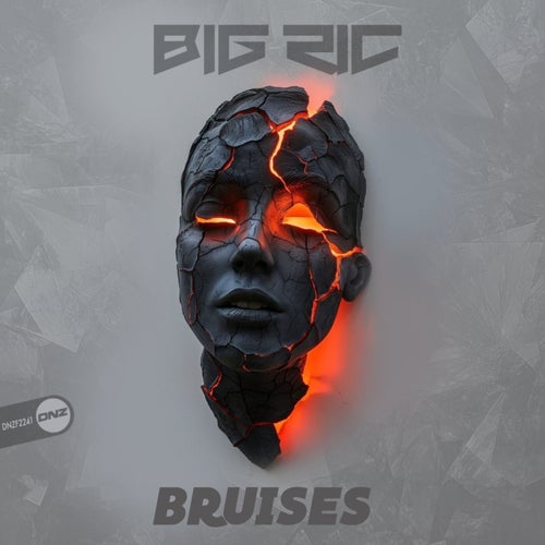 Bruises