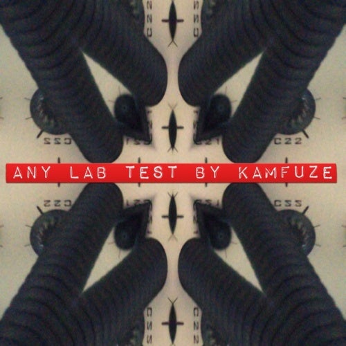 Any lab test