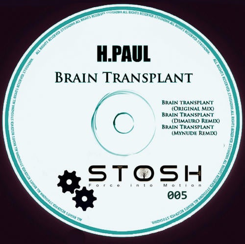 Brain Transplant