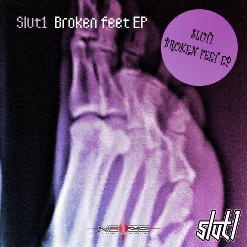 Broken Feet EP