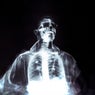 X-Ray