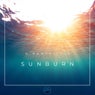 Sunburn