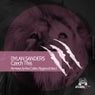 Czech This Remixes