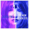 My New Black Eye