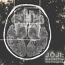 Magnetic Resonance